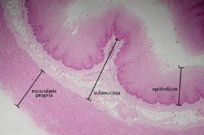 stratified squamous epithelium non keratinized esophagus