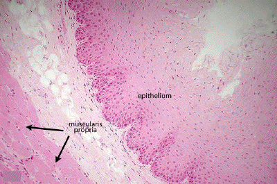 stratified squamous epithelium non keratinized esophagus