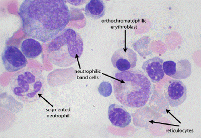 myelocyte and metamyelocyte